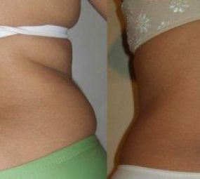 Massagem Corporal photo 1